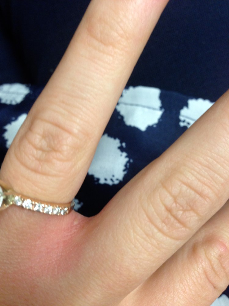 fire ants, florida, gardening,